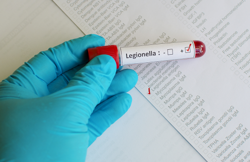 Cei Formación Online_Curso renovación Legionella: Mantenimiento higiénico-sanitario en instalaciones con riesgo de legionelosis (orden SCO/317/2003)