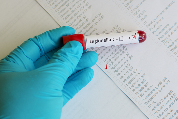 Cei Formación Online_Curso renovación Legionella: Mantenimiento higiénico-sanitario en instalaciones con riesgo de legionelosis (orden SCO/317/2003)