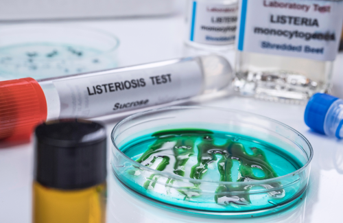 Cei Formación Online_Curso Listeriosis y otras enfermedades de transmisión alimentarias